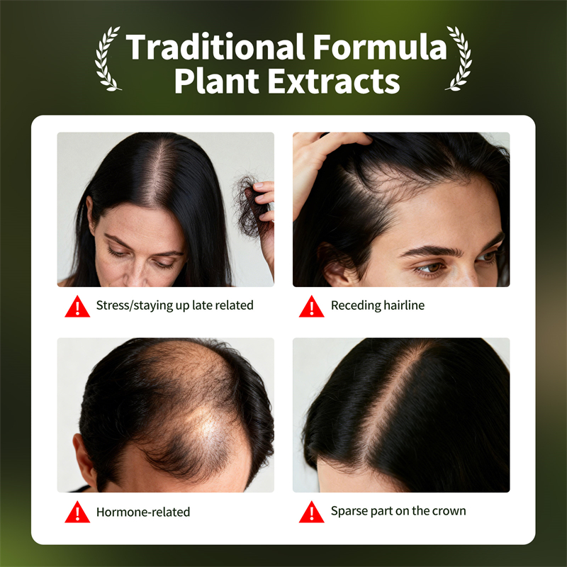 Natuurlijke Haargroei Set Usma - Hair Care Herbal recensie en prijs