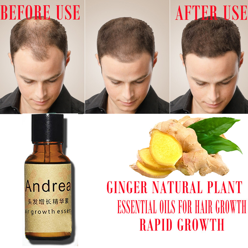 2/5/10 Stuks Andrea Haargroei  - Hair Care Herbal recensie en prijs