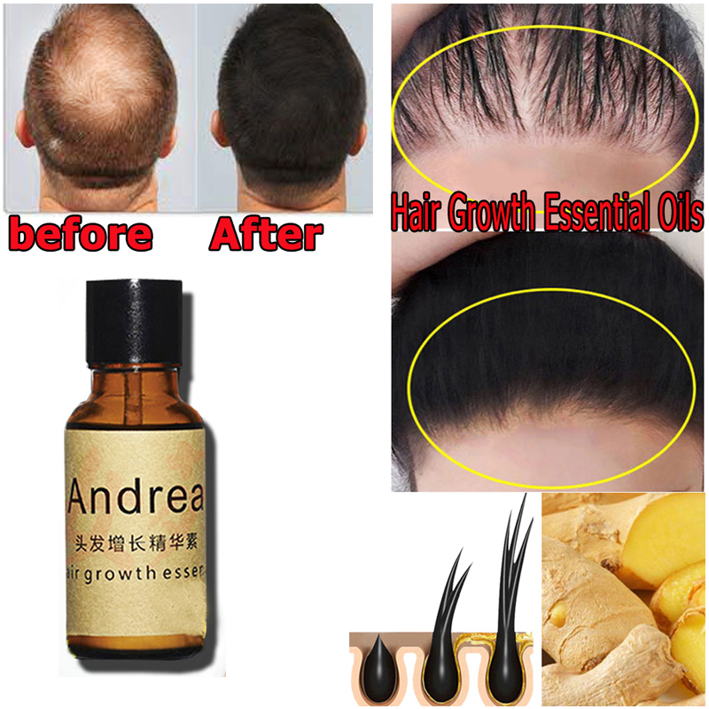 2/5/10 Stuks Andrea Haargroei  - Hair Care Herbal recensie en prijs
