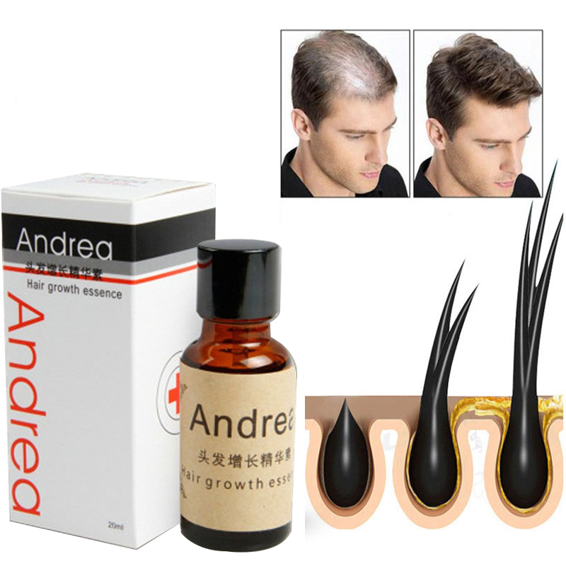 2/5/10 Stuks Andrea Haargroei  - Hair Care Herbal recensie en prijs